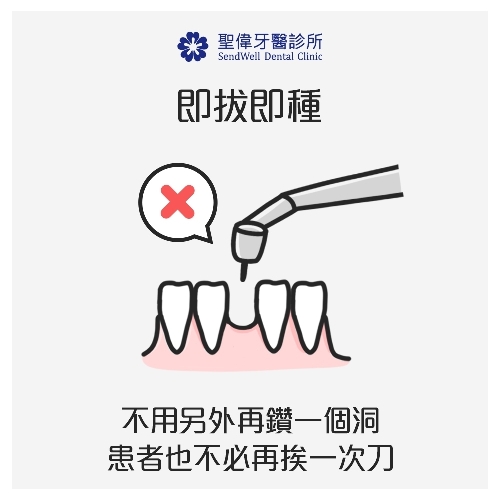 即拔及種。不用另外再鑽一個洞,患者也不必再挨一次刀