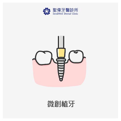 微創植牙,聖偉牙醫